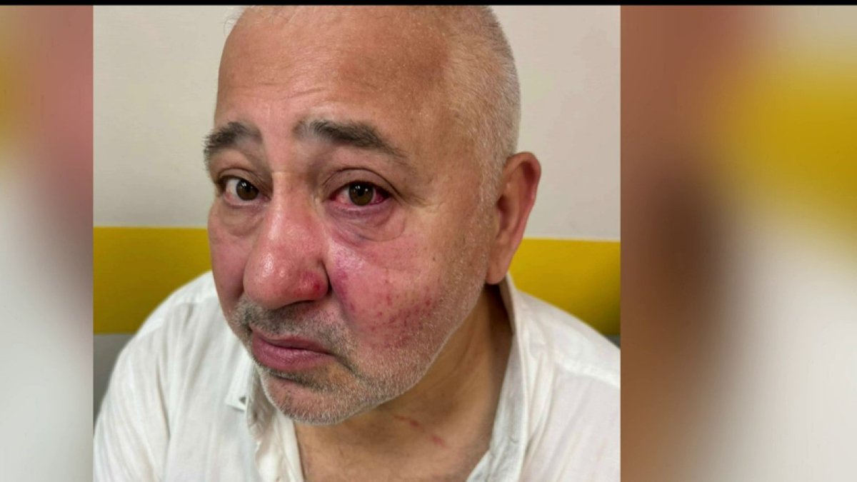 🔴 "Il m'a donné un coup de poing dans l'oeil, attrapé par le col de la chemise et arraché ma chaîne" : Dov Sitruk, victime d'une agression antisémite à Livry-Gargan, témoigne dans #LePrime sur i24NEWS