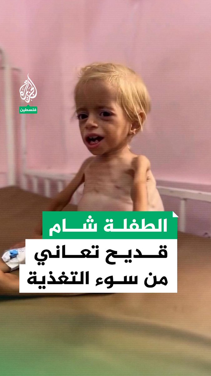 شام قديح.. طفلة فلسطينية تبلغ عاما ونصف تعاني من سوء تغذية حاد وتضخم في الكبد، في ظل الإمكانيات الطبية الضعيفة بمستشفيات غزة تحت الحصار والإبادة #حرب_غزة