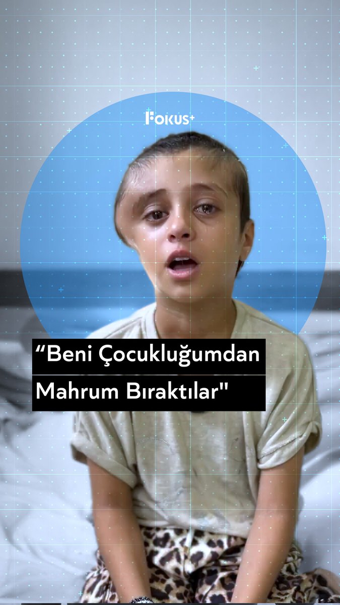 ➕“Beni çocukluğumdan mahrum bıraktılar” ▪️“Eskiden gerçekten çok güzeldim” ▪️Gazze’de işgalci İsrail saldırısında yaralanan küçük bir kız, başından geçirdiği operasyon sonrası yaşadığı acıyı anlattı: “Eskiden çok güzeldim… Ameliyat oldum, herkes benimle dalga geçiyor.” dedi ve gözyaşlarına boğuldu.