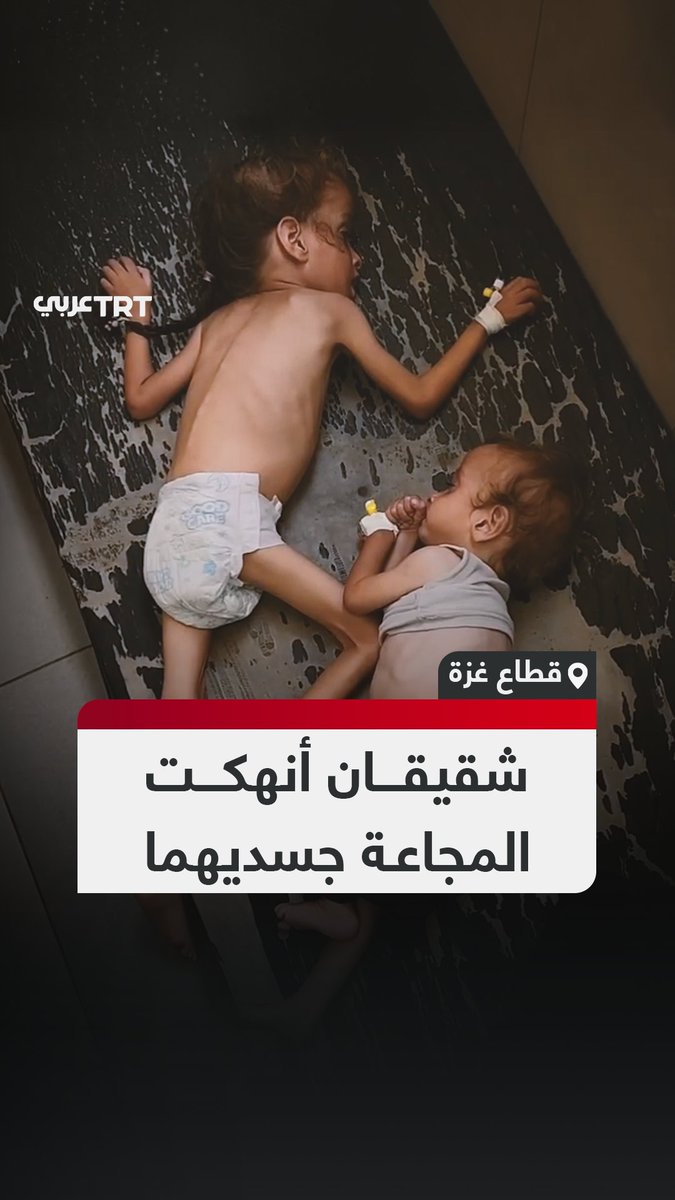 لا يقويان على الحركة.. طفلان شقيقان فلسطينيان تظهر على جسديهما آثار المجاعة جراء الحصار الذي يفرضه جيش الاحتلال الإسرائيلي على قطاع غزة. #تفاعل ليصل إليك كل جديد