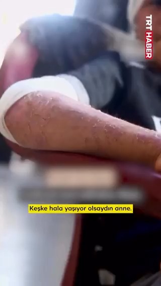 🔴İsrail’in saldırılarında yaralanan Gazzeli çocuk, katledilen annesini gözyaşlarıyla anlattı. "Keşke hala yaşıyor olsaydın anne"