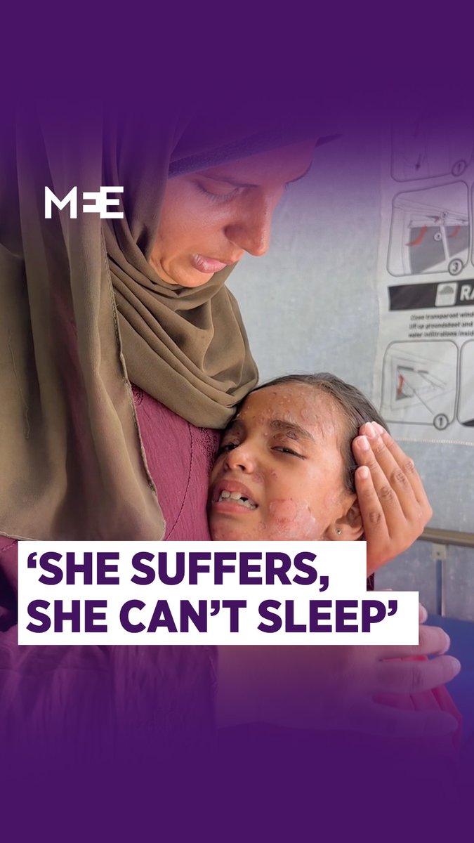 Fatima Abou Baltak is among hundreds of children suffering from skin diseases that have spread across Gaza due to a crushing Israeli blockade that has prevented the entry of sanitary products. “She suffers, she can’t sleep, I swear to God she doesn’t sleep,” says her mother.