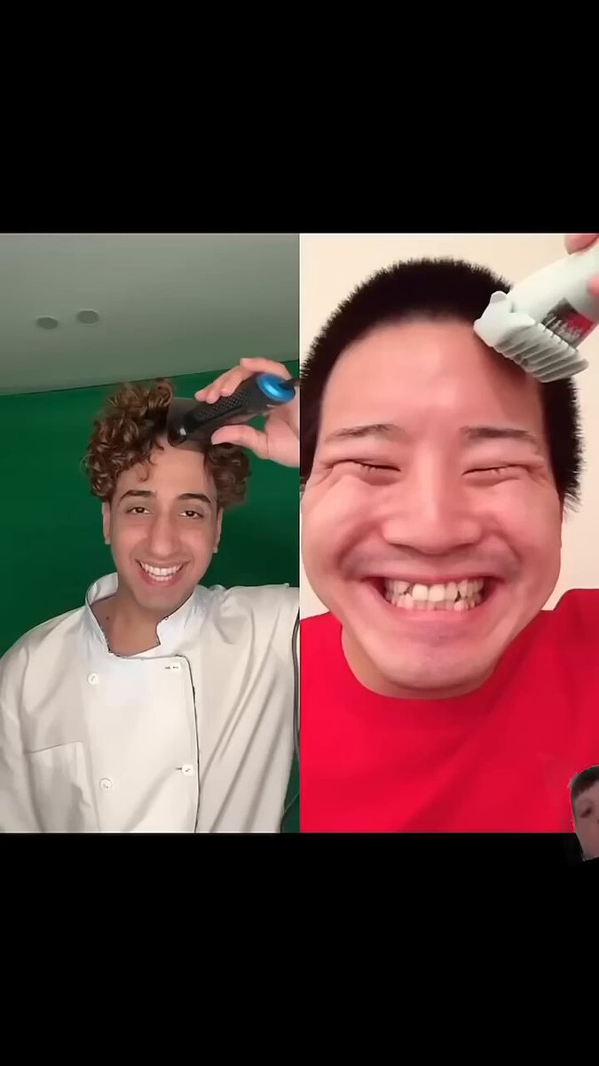 Oh dont worry buddy , It will grow back in a few months 😅😂