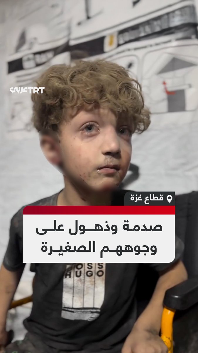 علامات الصدمة والذهول علت وجوههم الجريحة.. أطفال مصابون يصلون إلى مستشفى الشفاء إثر استهداف منزل في منطقة عبد العال بمدينة غزة أمس #تفاعل ليصل إليك كل جديد