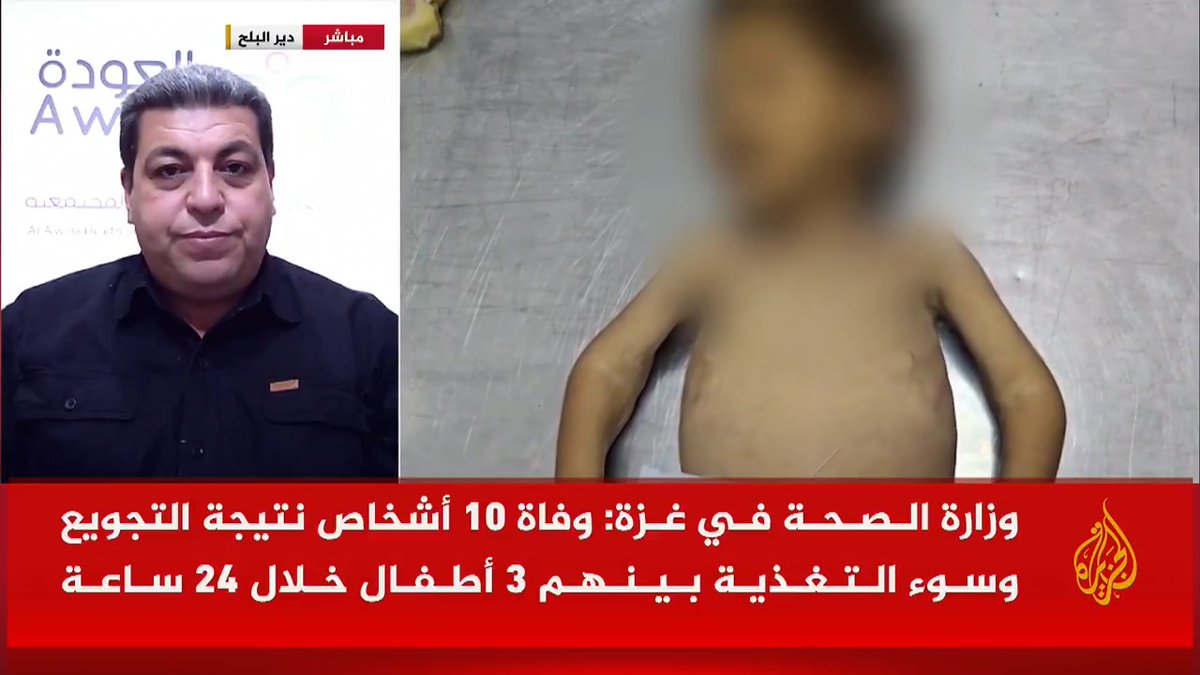 المدير العام لجمعية العودة الصحية والمجتمعية بغزة للجزيرة: الوضع كارثي في قطاع #غزة بسبب نقص الغذاء والدواء، والموت مستمر بسبب المجاعة والقصف الإسرائيلي #حرب_غزة #الأخبار
