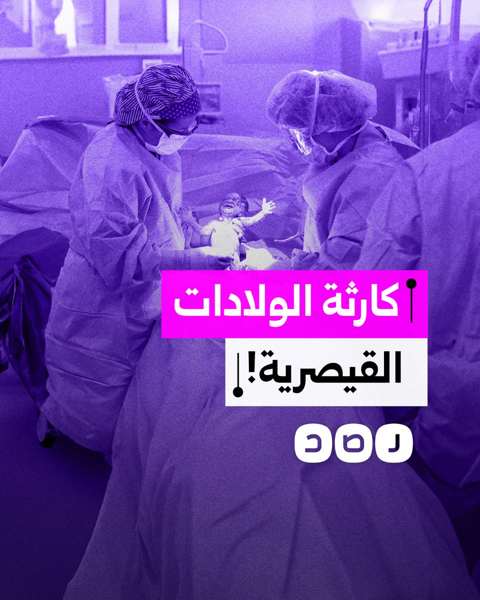 مصر الأولى عالميًا في الولادة القيصرية.. ما السبب؟