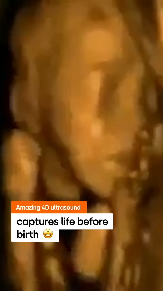 Watch as 4D ultrasound showcases life before birth - unforgettable! 🥰