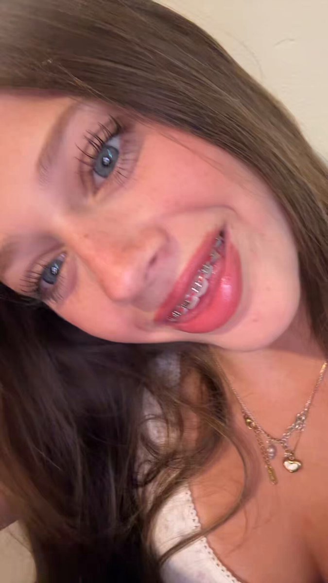 braces and hypnotising blue eyes make for hardcore faceporn 🤤