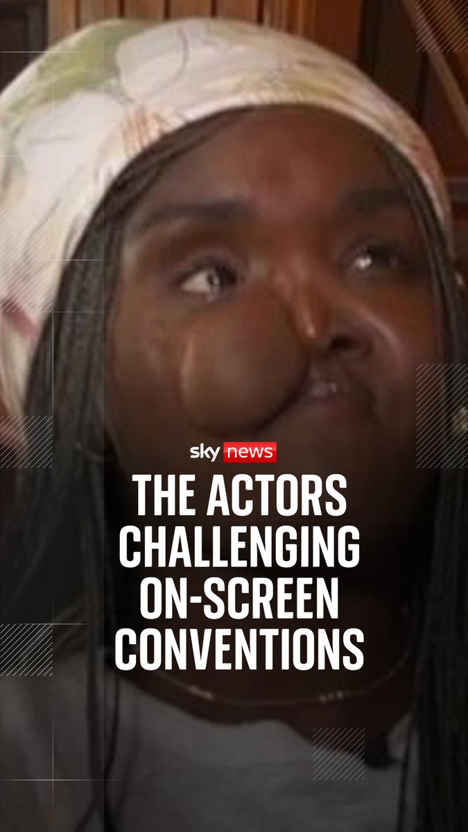 Nearly one in five people in the UK self-identifying as having a visible difference such as a mark, scar or condition, according to charity Changing Faces. Sky's arts and entertainment reporter Bethany Minelle reports 🔗