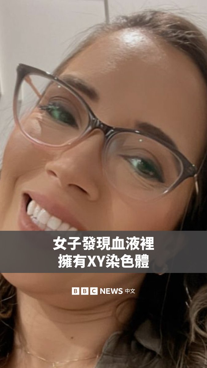 安娜·保拉偶然发现,她的血液中带有与男性特征有关的XY染色体。她在其他地方是XX,但她的血液里似乎有她哥哥的DNA。这是怎么回事呢?