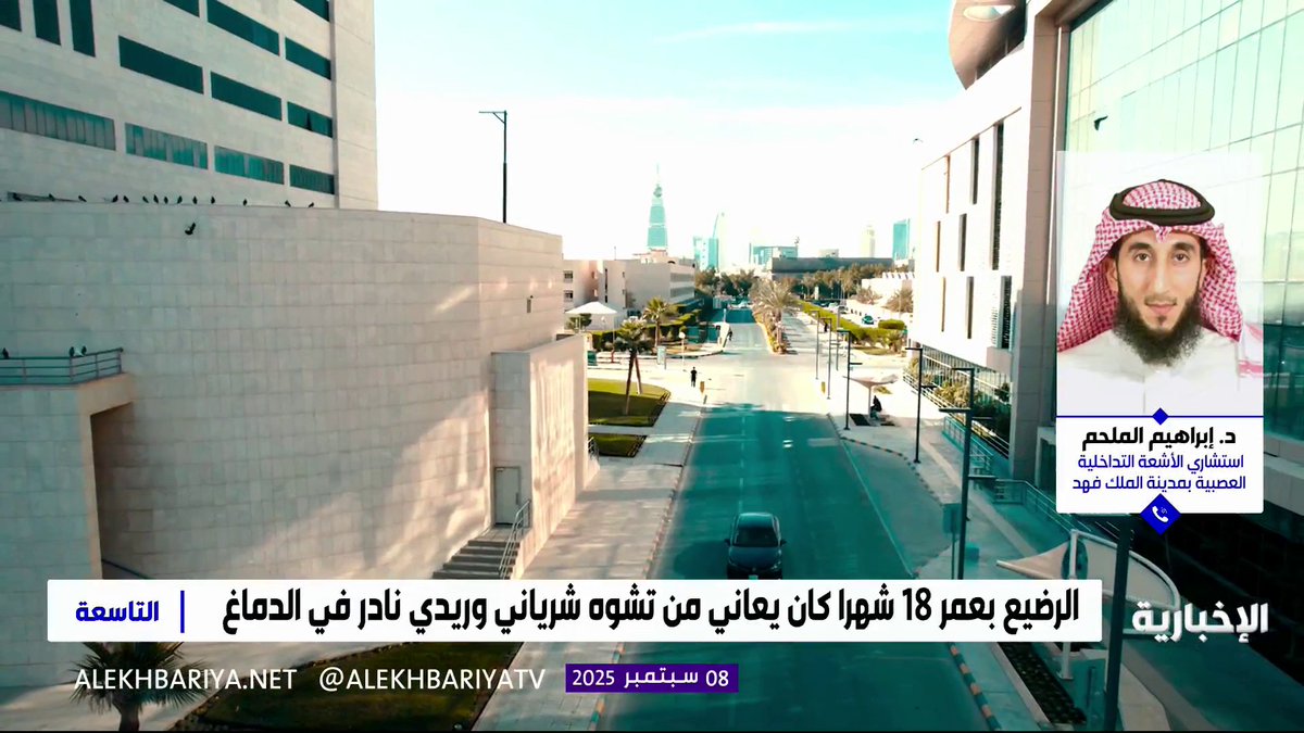 إنقاذ رضيع يبلغ من العمر 18 شهرا يعاني من تشوه شرياني وريدي نادر في الدماغ.. استشاري الأشعة التداخلية العصبية بمدينة الملك فهد الطبية د.إبراهيم الملحم: حالة الطفل لا تصيب إلا مولودا من بين 3 ملايين عالميا وأسبابها وراثة جينية #التاسعة | #الإخبارية