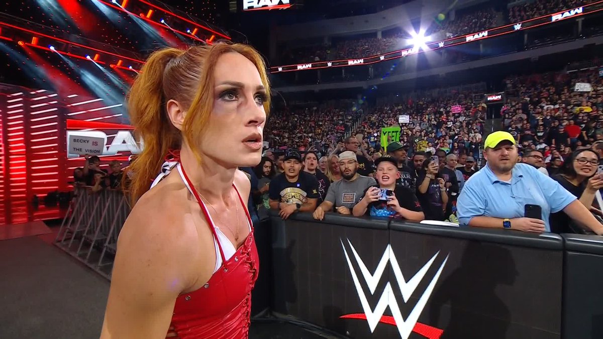 Hey Becky, nice shiner! How'd you get that? 😉