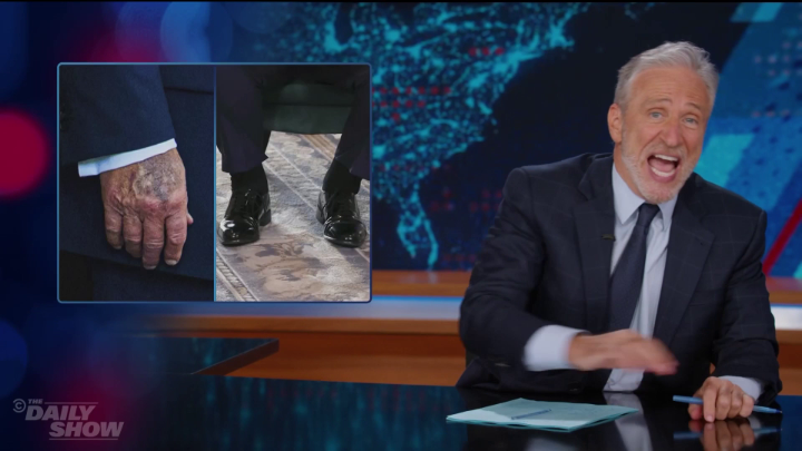 Trump's bruises have Jon worried that the president has gone full-blown Grimace