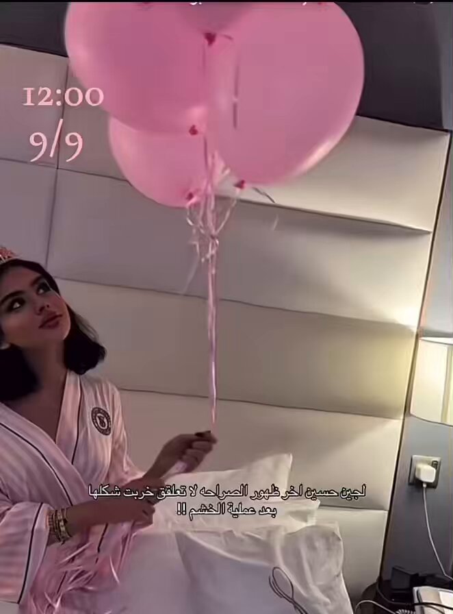 ام رموش بعد عملية خشمها صارت كنها بنت مريم حسين