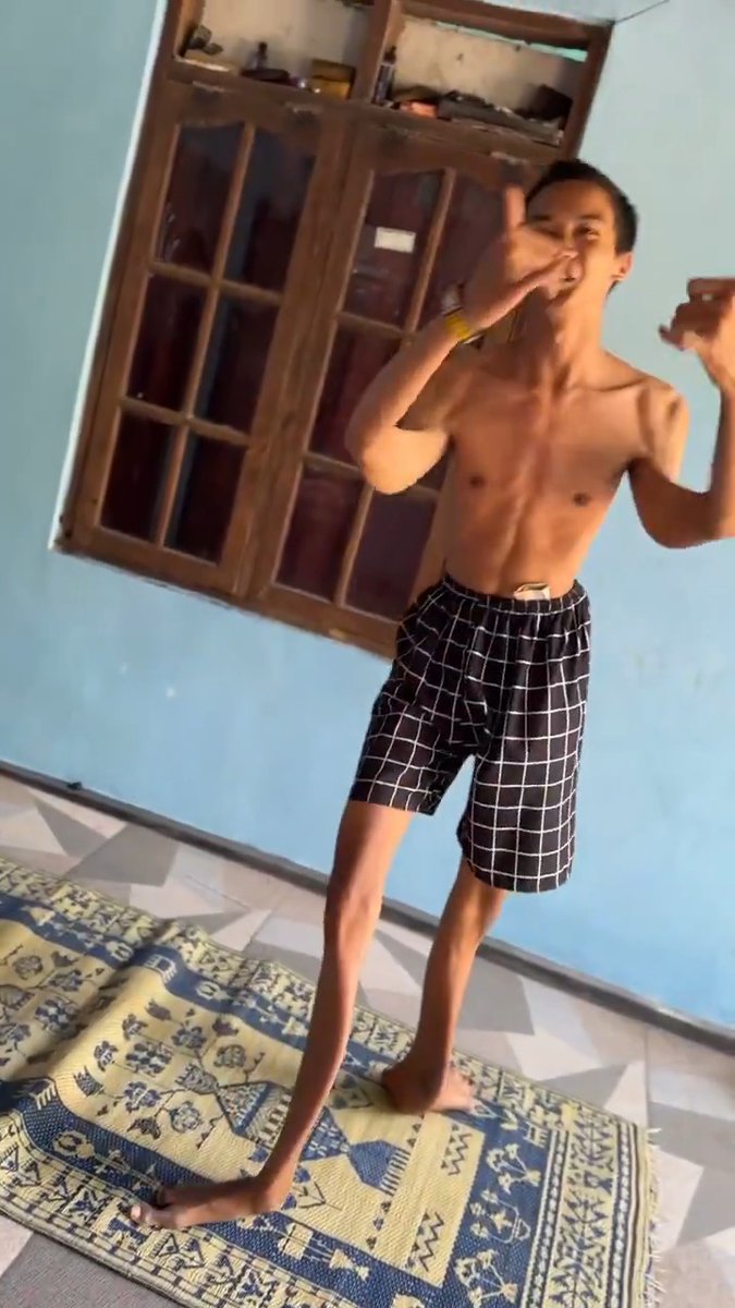 Does anyone know what this condition is called?