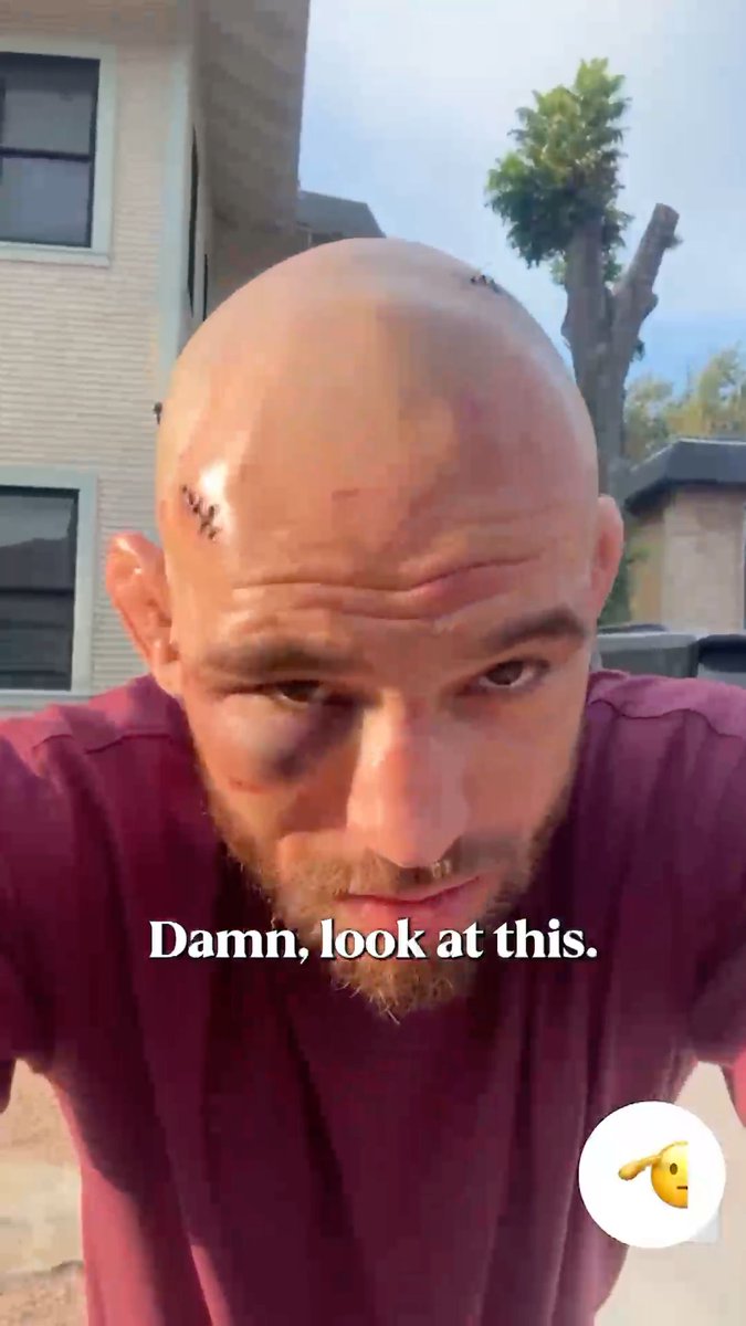 Jean Silva reacts to his loss to Diego Lopes at #NocheUFC... and shows the battle scars 🤕