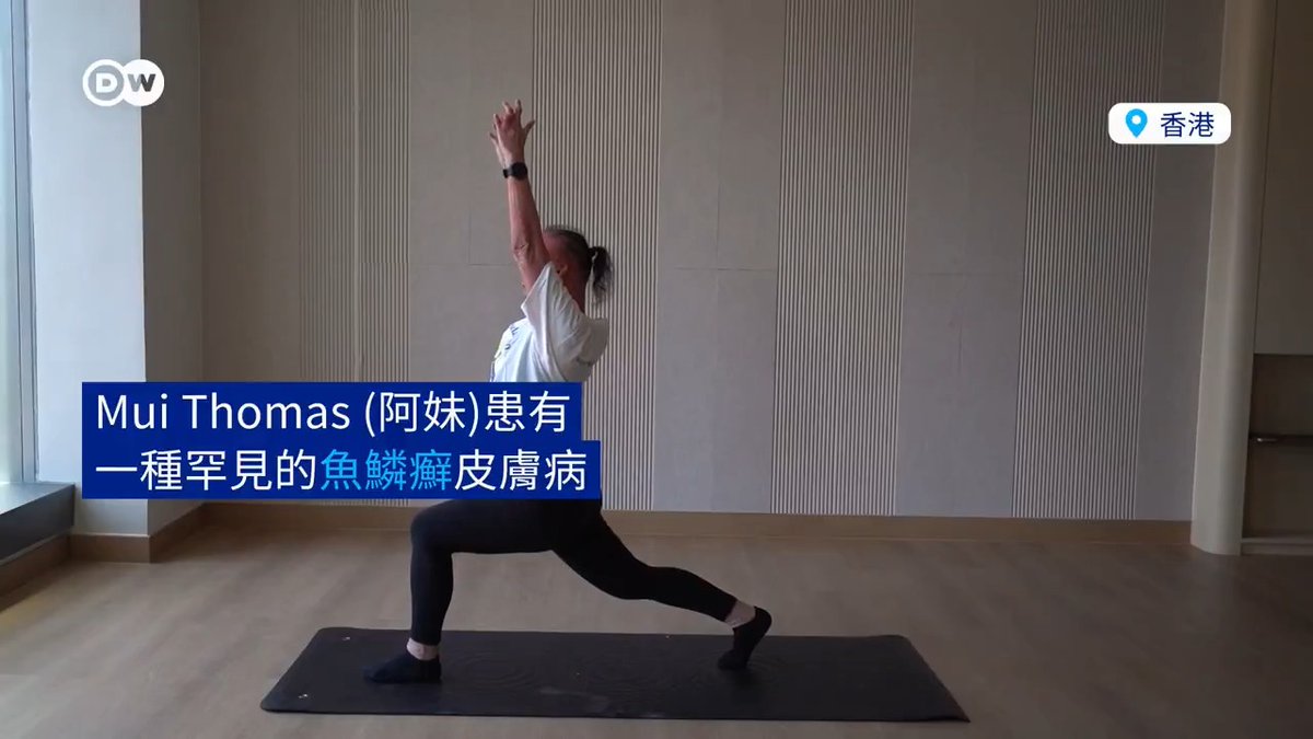 乐观的香港女孩 香港女孩“阿妹”(Mui Thomas)天生患有一种罕见的皮肤病。尽管面临生活中的各种困难和网络霸凌,她仍成为一名成功的运动教练。