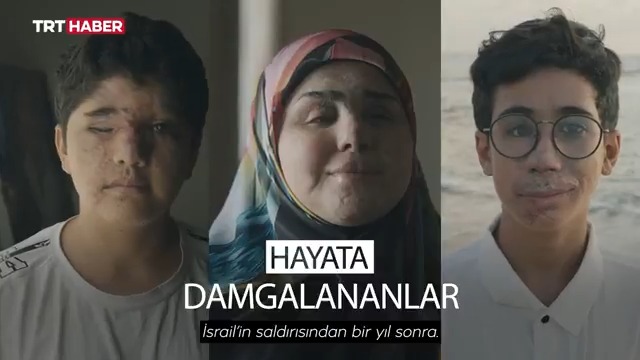 Terör devleti İsrail’in Lübnan'da gerçekleştirdiği telsiz saldırısının üzerinden bir yıl geçti. Saldırıdan sağ kurtulanlar, yaşadıklarını TRT World’e anlattı. 📌"Ses öyle yüksek ve rahatsız ediciydi ki ben ve birçok yaralı bunu bir çeşit hipnoz gibi nitelendirdik."