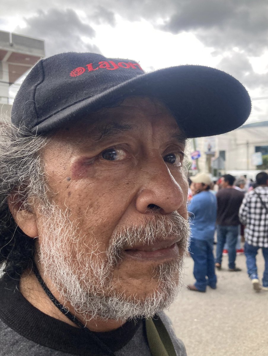 La Presidencia de la República suspendió en sus funciones a un empleado de Comunicación Social por haber golpeado al corresponsal de La Jornada, Sergio Ocampo Arista, al concluir un acto de la presidenta Claudia Sheinbaum en Chilpancingo. #VideosLaJornada