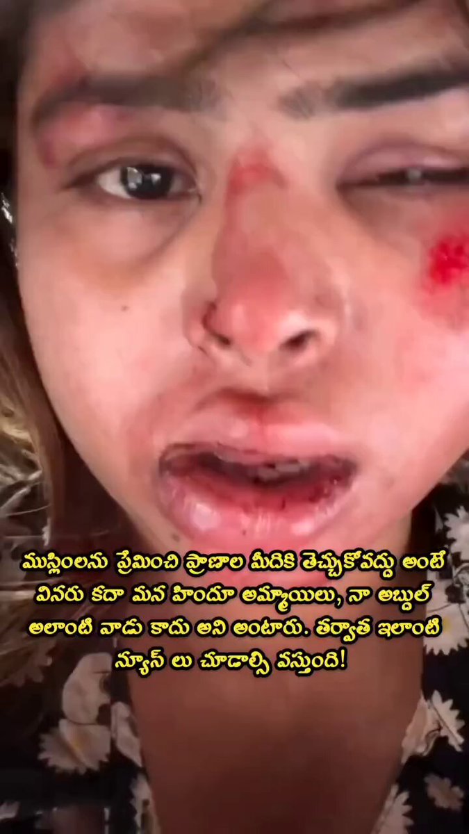 Another “mera abdul alag hai” sherni. Now realised, after getting her ‘present’ - bruises.