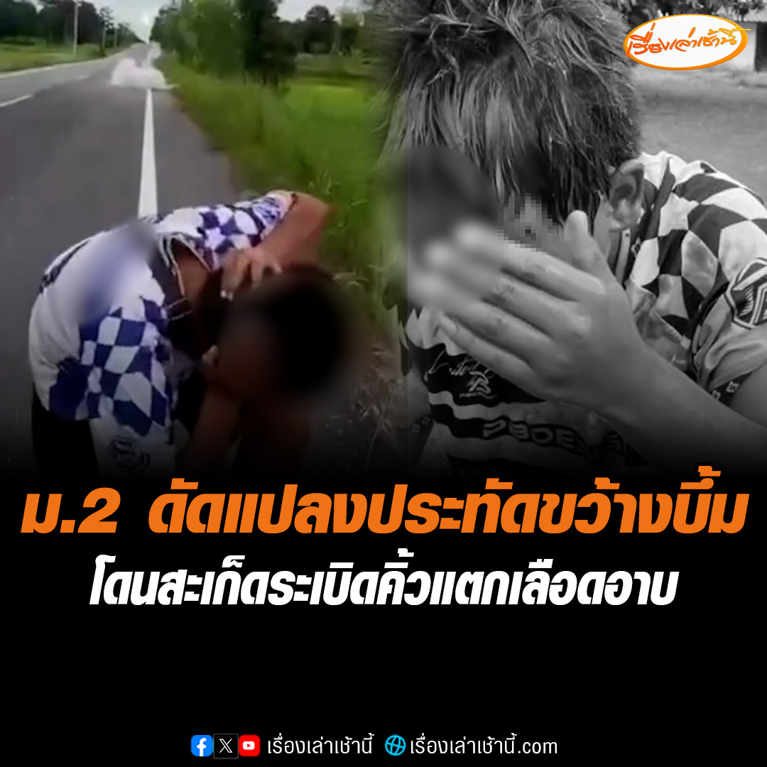 อย่าหาทำ! เด็ก ม.2 ดัดแปลงประทัดขว้างบึ้ม สะเก็ดกระเด็นถูกหางคิ้วแตกเลือดอาบ เพื่อนรีบพาส่ง รพ.สต. บอกหมอหกล้มก้อนหินบาด สุดท้ายรู้ความจริงทำเอาหัวจะปวด #เรื่องเล่าเช้านี้ #ข่าวช่อง3 #ข่าวภูมิภาค #มหาสารคาม