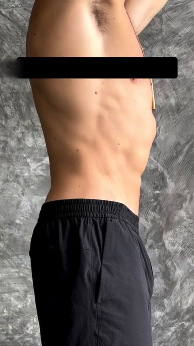 Stuck In Hyperlordosis? Do This👇👇👇