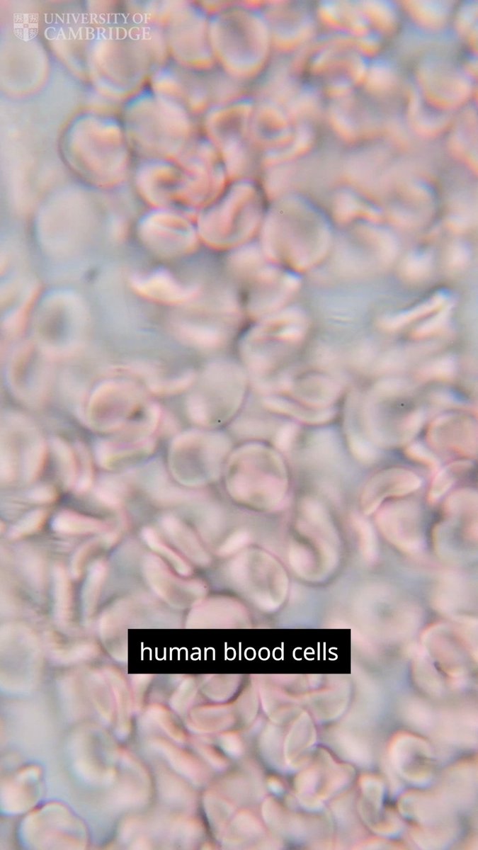 Researchers Gurdon Institute have found a new way to grow human blood cells in the lab 🧫 A major step towards regenerative therapies, this could also help scientists with better understanding blood disorders like leukaemia. More on this discovery 👇