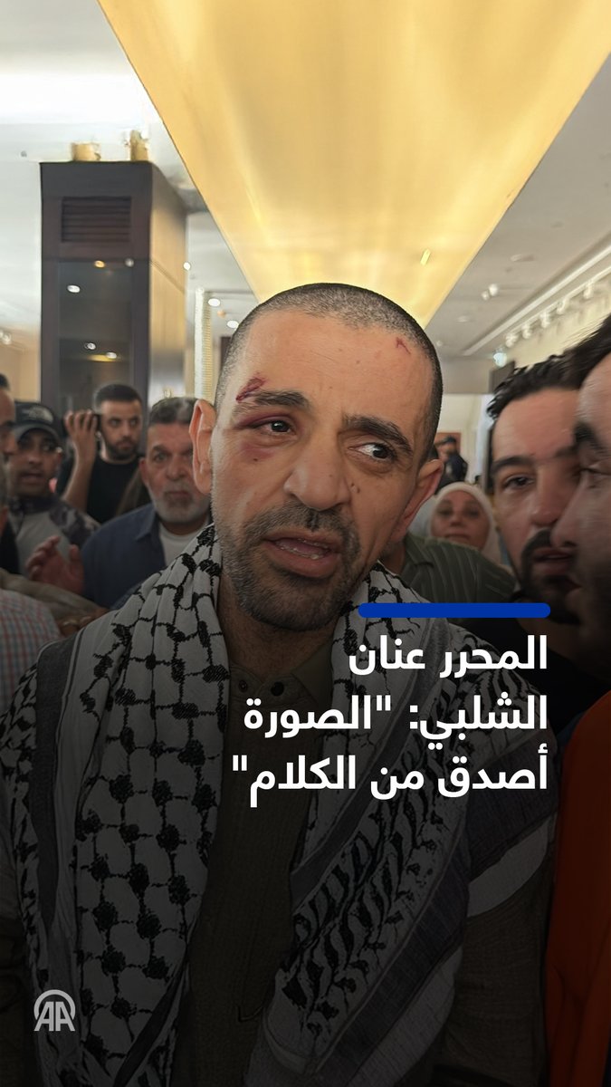 بعد 24 عامًا في السجون الإسرائيلية، خرج الأسير المحرر عنان الشلبي مثخنًا بالجراح، قائلاً للأناضول: "الصورة أصدق من كل الكلام" في إشارة إلى ما تعرّض له من اعتداء على يد #الجيش_الإسرائيلي قبيل الإفراج عنه.