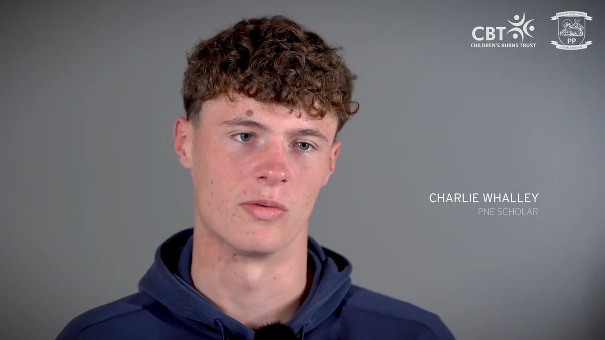 At 15 months old, a pan of boiling water spilt over PNE scholar Charlie Whalley, leaving him with lifelong scars. 15 years later, on National Burn Awareness Day, Charlie shares his story. 🤍 #pnefc | ChildrensBurnsTrust