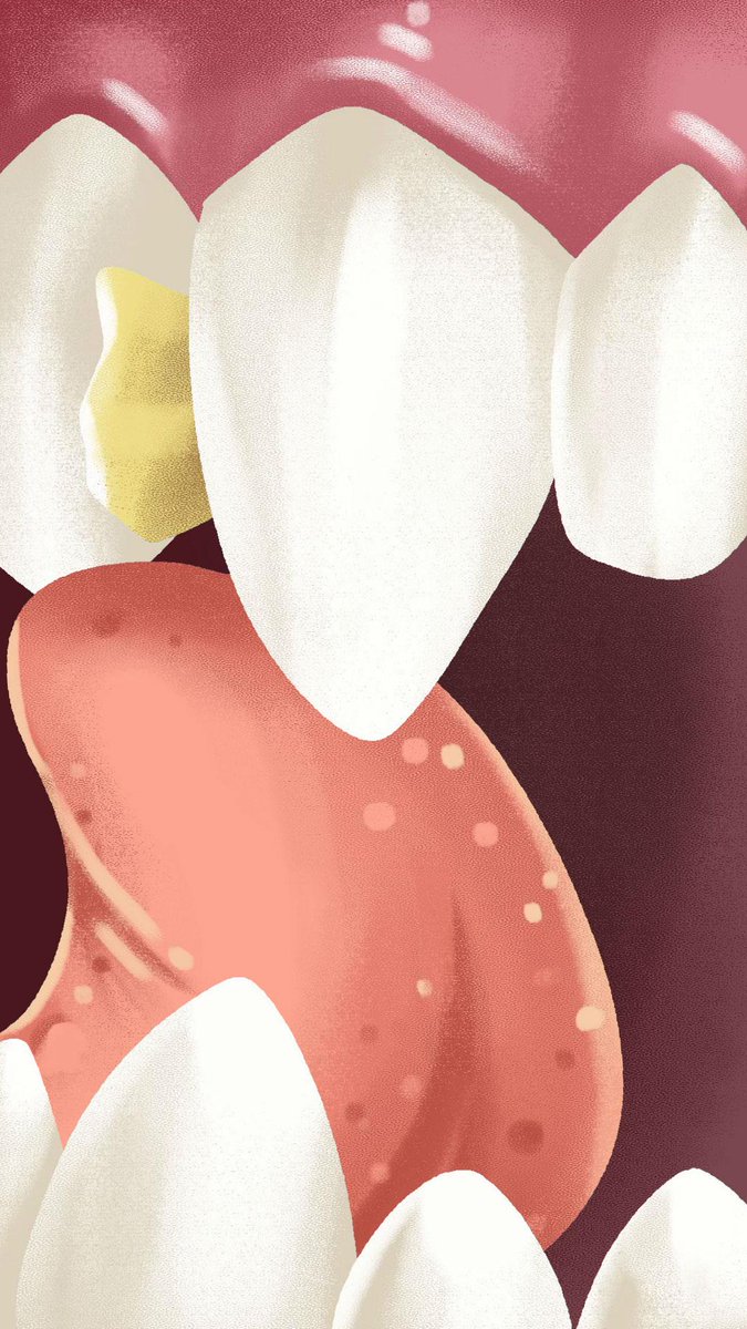 Oh I hate that... #chiknnuggit #animation #popcorn #teeth