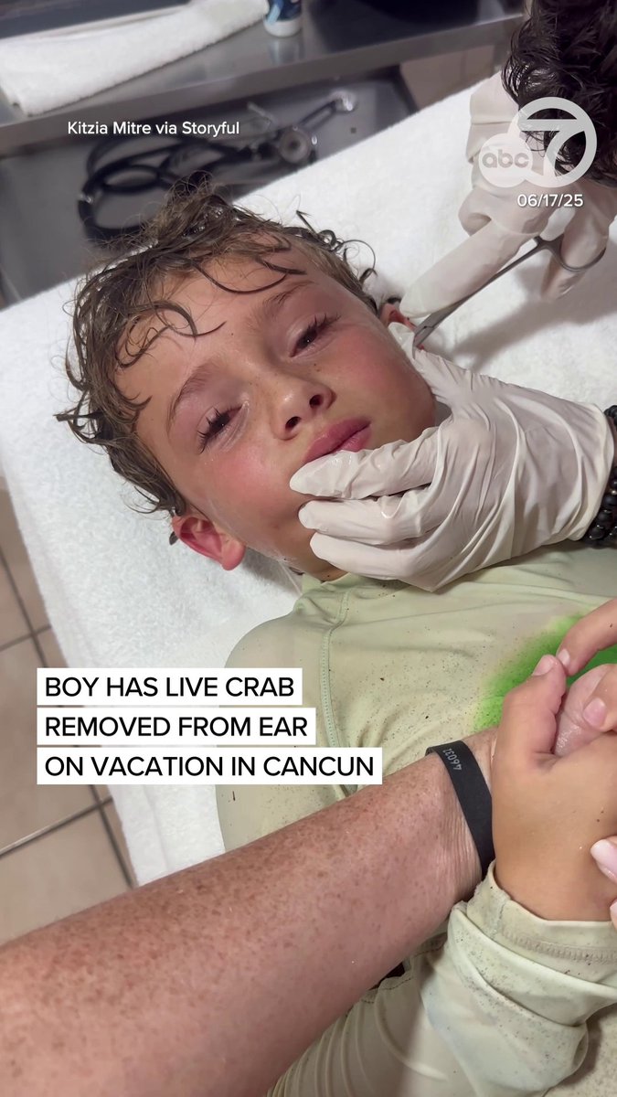 Boy has a live crab removed from his ear on vacation in Cancun. The boy was swimming when he felt something crawl in his ear. 😳