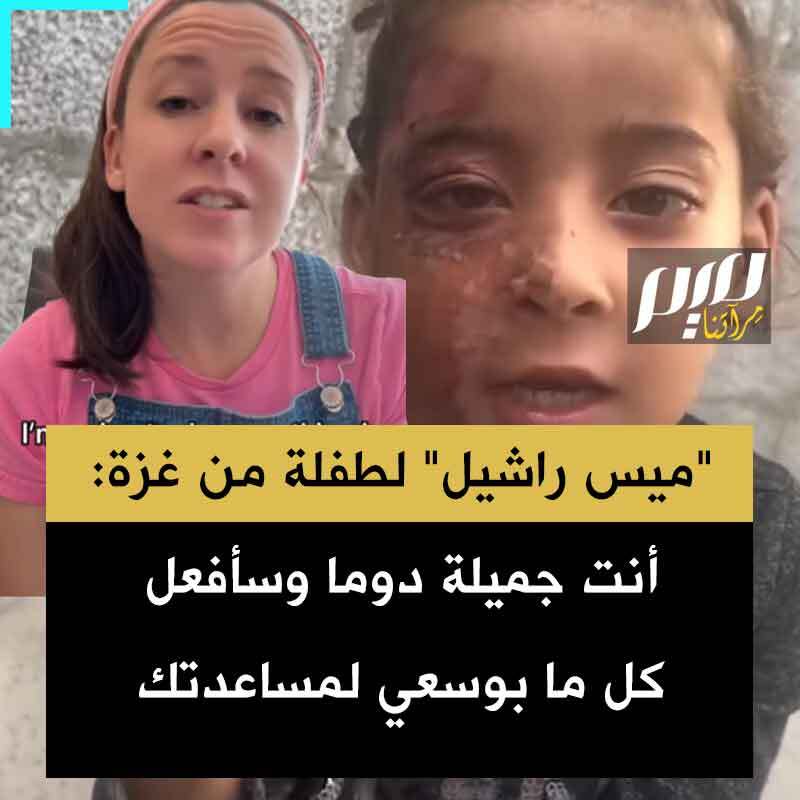 في رسالة مؤثرة إلى الطفلة إيلين التي أصيبت في وجهها جراء قصف غزة، وجّهت المؤثرة الأمريكية الشهيرة "ميس راشيل" كلمات مفعمة بالحنان والعطف: "أنت جميلة دوما.. سأفعل كل ما بوسعي لمساعدتك.. كل طفل من حقه الحصول على رعاية طبية".