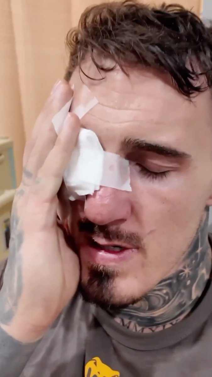 "I really respect what Bisping has done... I wouldn't carry on fighting with one eye. No chance." Tom Aspinall explains that his eye injury has given him a new perspective on the achievements of Michael Bisping. Watch the full video from Tom Aspinall on his YouTube now ▶️