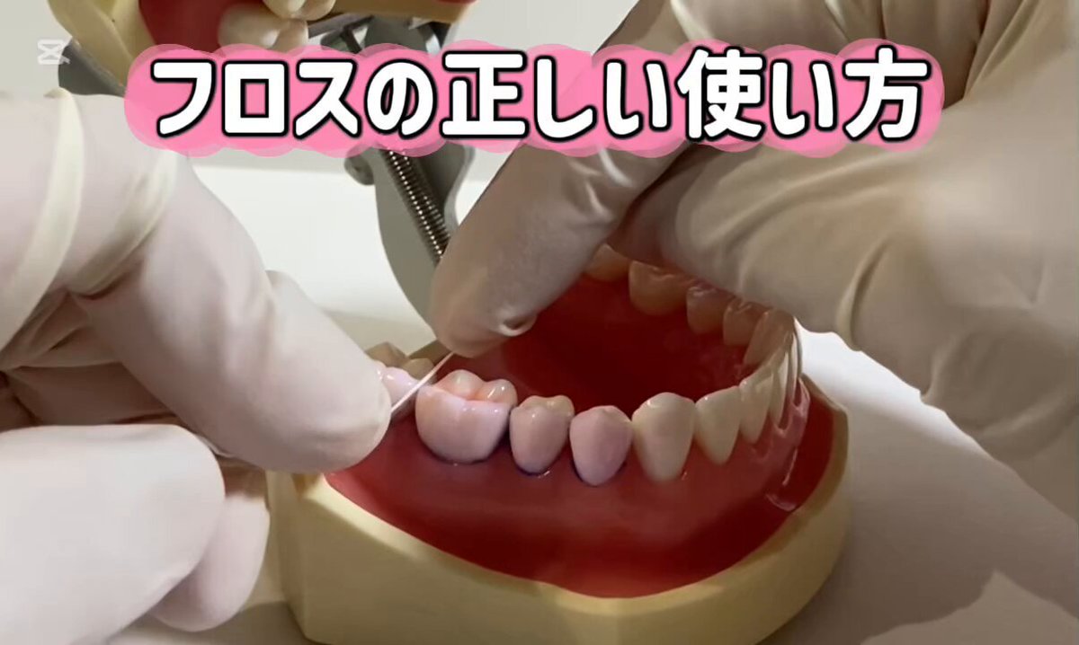 9割が間違えるデンタルフロスの使い方。 〇〇すると歯が削れて知覚過敏に。 動画を最後までチェックしてね↓