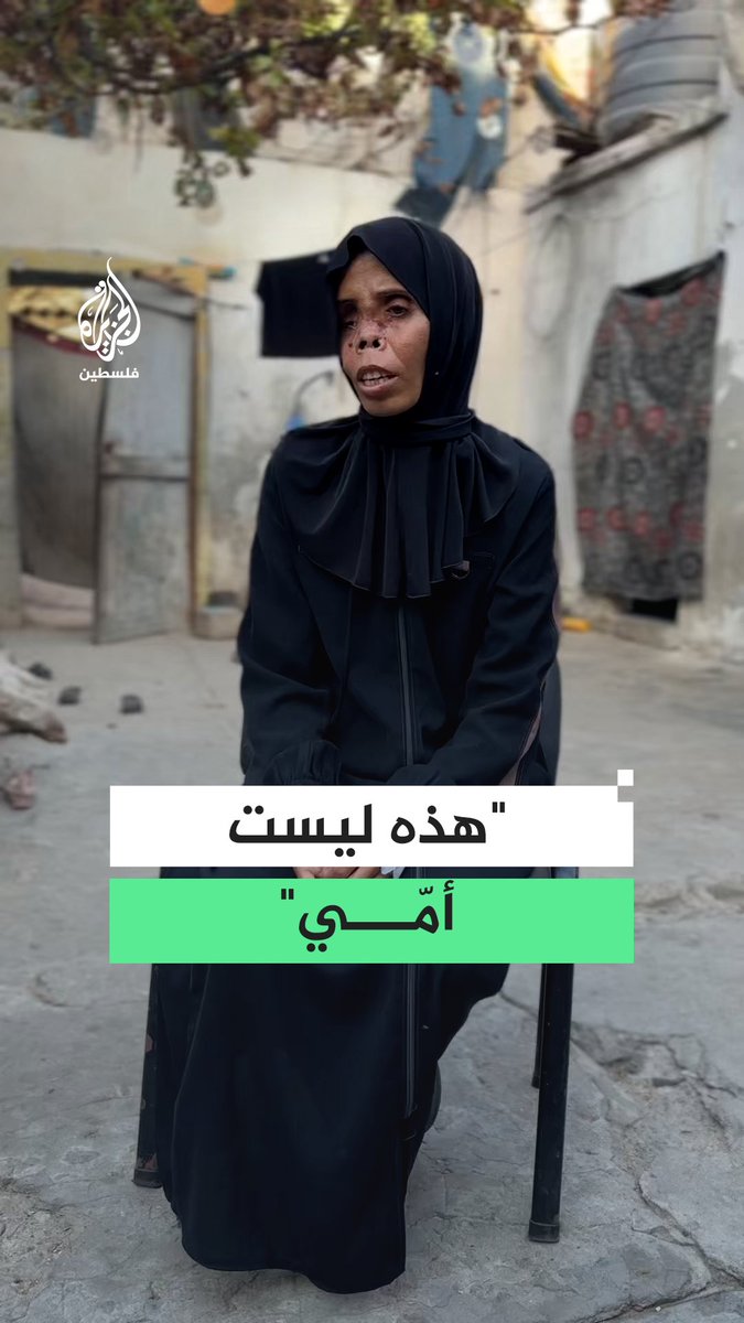 كل حاجة تغيّرت في حياتي.. الحرب تفقد الفلسطينية نجوى أبو عطيوي إحدى عينيها وتغير ملامح وجهها #رقمي