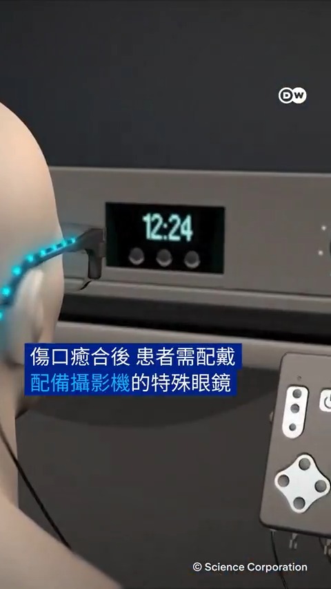 在不久的未来,重见光明可能不再是梦: 一项新的临床试验正在测试一种视网膜晶片和AI眼镜,以帮助因眼疾失去视力的患者重见光明。#DWDigital