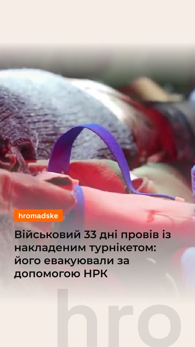 Військовий з тяжким пораненням провів 33 дні з накладеним турнікетом. Його вдалося евакуювати лише з сьомої спроби. Для цього використали наземний роботизований комплекс. Історію його порятунку розповів Перший окремий медичний батальйон. Як це було — дивіться у відео
