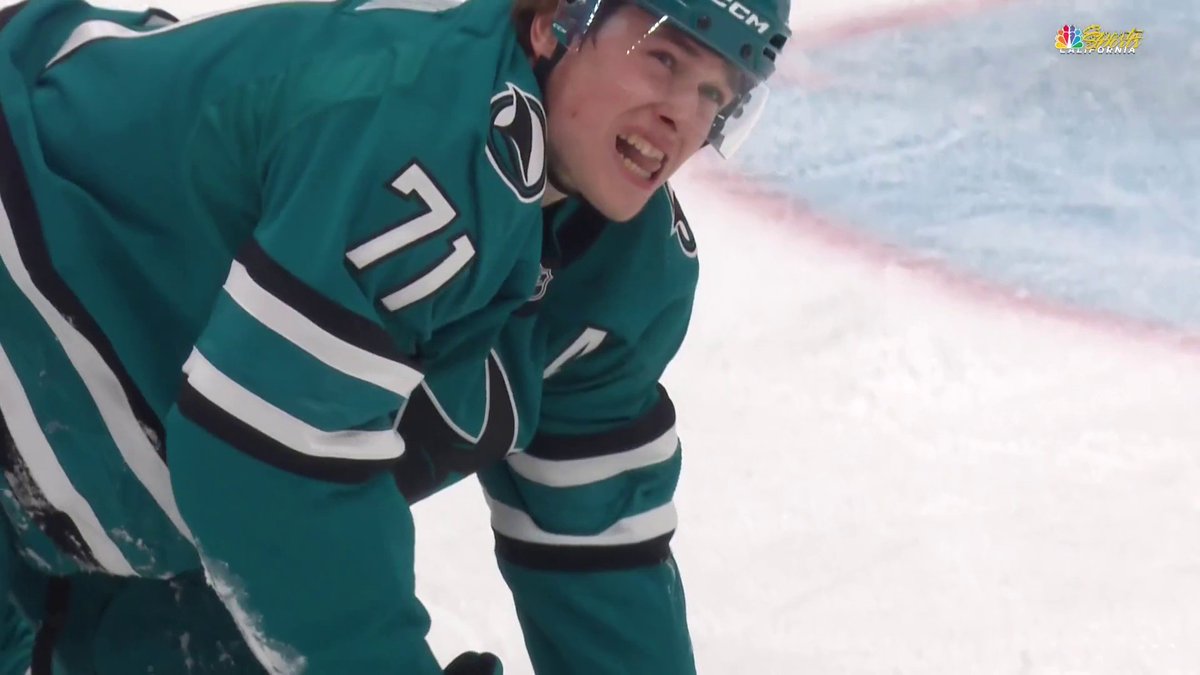 Macklin Celebrini got his teeth chipped after taking a stick to the face 😬