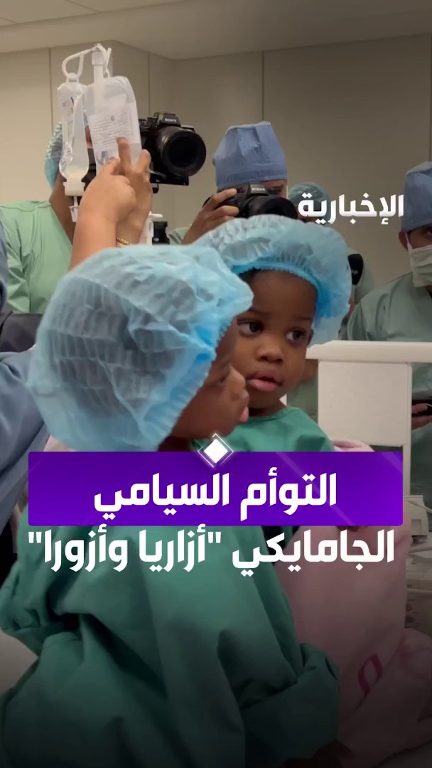 لحظة دخول التوأم السيامي الجامايكي "أزاريا وأزورا" إلى غرفة العمليات عبر مراسلة #الإخبارية لمى الغامدي