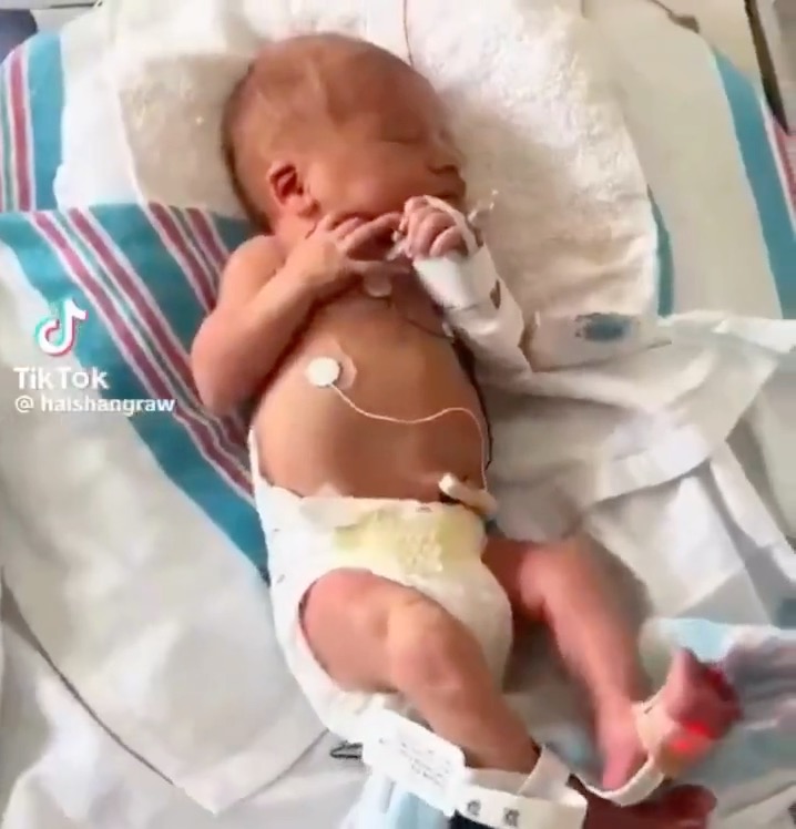 This is what a 34-week-old baby looks like. And Democrats still support allowing babies like this to be killed in the womb.