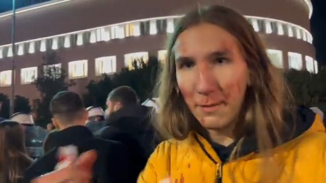 Student Vukašin Đinović povređen je danas tokom sukoba sa policijom u Novom Sadu, kada su pripadnici različitih jedinica grubo odgurivali štitovima građane, koji su hteli da ih spreče da odvuku autobus Milomira Jaćimovića.