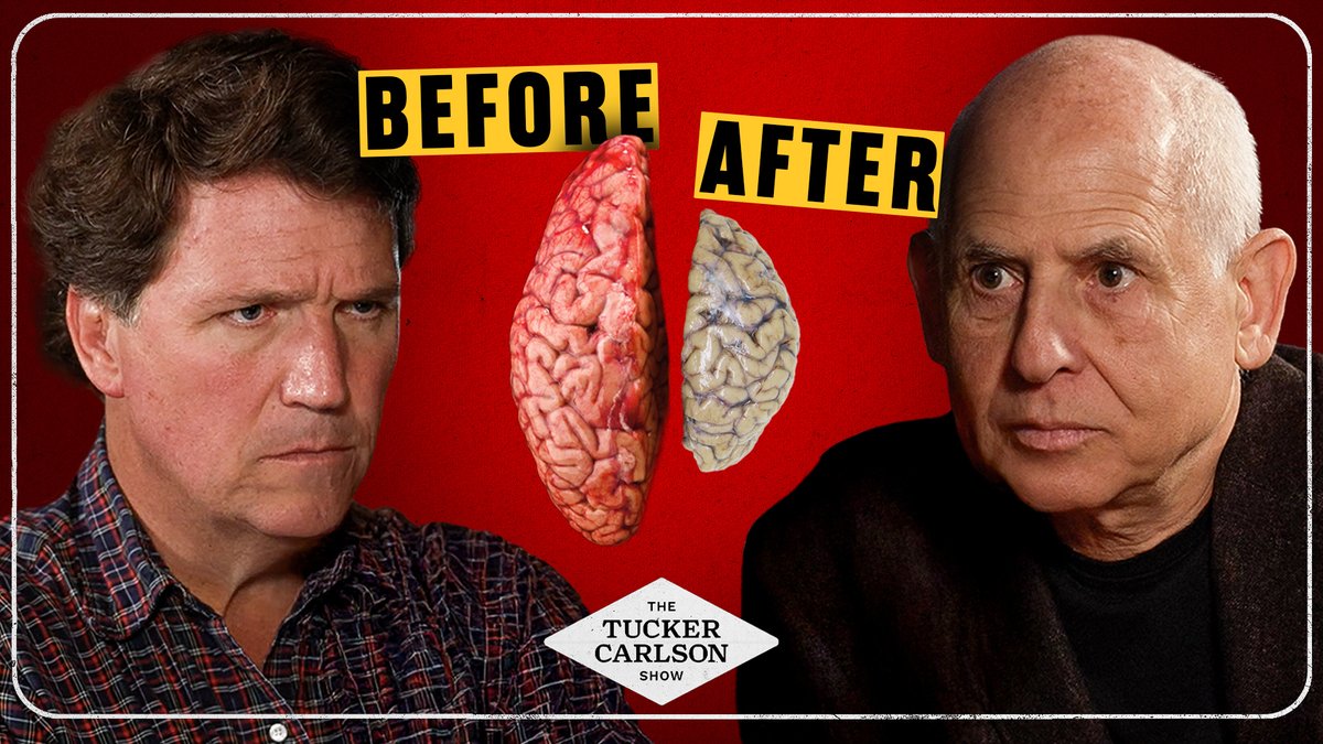 Once you understand just how destructive cannabis is to young men, it’s hard not to see it as a tool of social control. Dr. Daniel Amen explains. (0:00) How Does Marijuana Affect the Brain? (3:03) The Connection Between Marijuana and Psychosis (12:35) Why Is Brain Damage on the Rise? (15:18) Psychosis and Schizophrenia (21:58) Does Obesity Decrease the Size of Your Brain? (24:45) What Does Marijuana Do to Testosterone Levels? (25:11) Is This Contributing to the Rise of Autism? (31:41) Don't Believe Everything You Think (34:08) Is Marijuana a Medicine? (38:23) Should Marijuana Be Legal? (40:41) Is Marijuana Ruining Your Marriage? (44:51) Does Marijuana Increase Your Risk of Dementia? (55:00) Why Isn’t the Government Sounding the Alarm About Marijuana? (57:02) The Increase in Mushroom Use and Its Risks (1:02:14) What Is Kratom? (1:07:05) AI Is Destroying Your Brain (1:13:40) The Spiritual Impact of an Unhealthy Brain (1:16:10) How Hard Is It to Get Off Marijuana? (1:21:08) How to Protect Your Brain (1:28:48) Did Covid Damage Your Brain? (1:31:28) Can You Reverse Brain Damage? (1:34:31) Why Is There a Rise in Alzheimer's? (1:36:52) How to Manage Your Mind (1:47:20) Is Violence the Result of an Unhealthy Brain? Includes paid partnerships.