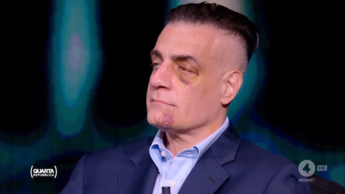 "Sono stato portato via in barella, l'occhio per la prima mezzora non vedo nulla. Con la Tac abbiamo escluso i danni maggiori. Sono zingari che vengono dalla Romania che fanno rapine." #Cicalone #quartarepubblica