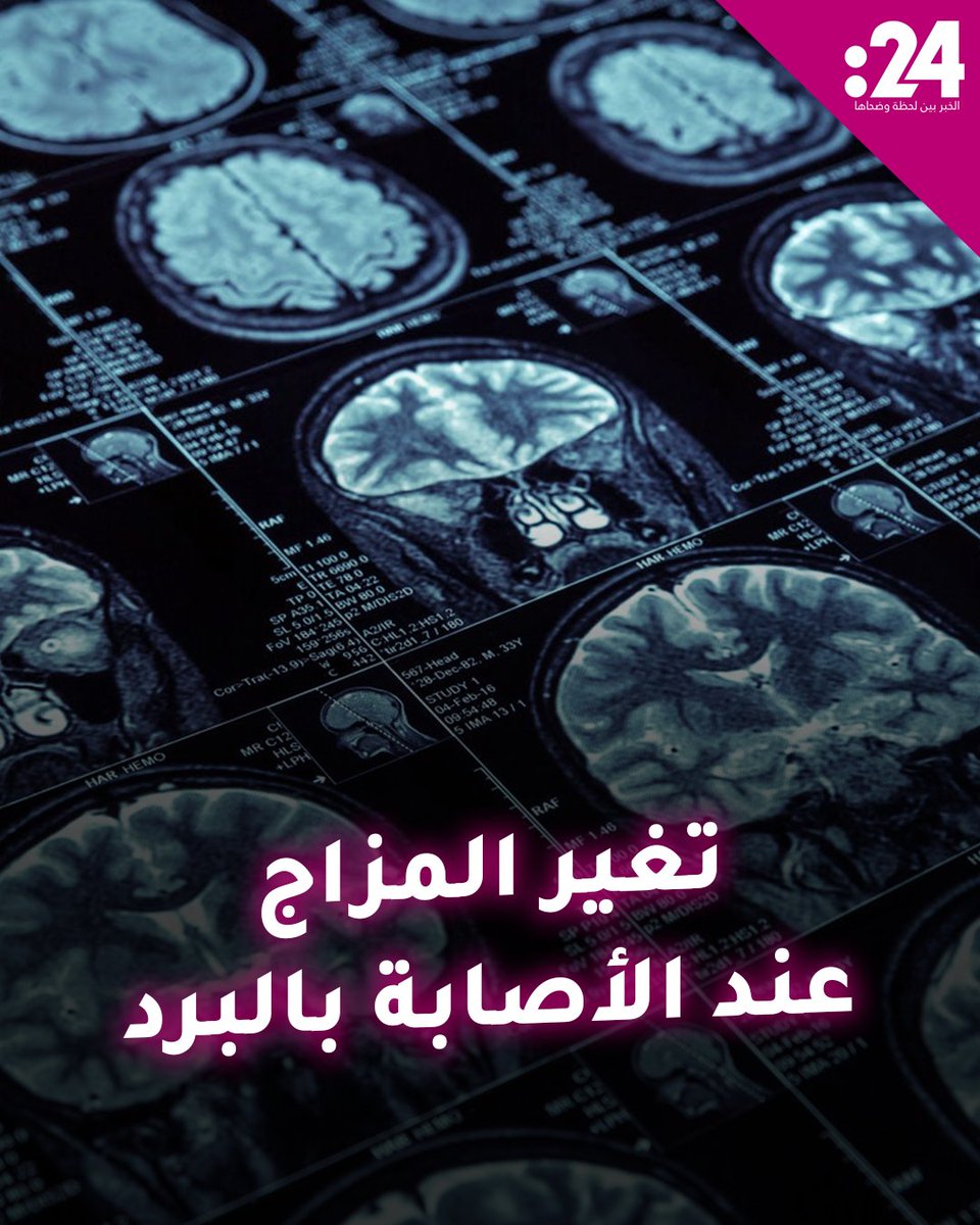 لماذا يتغير مزاجك عند الإصابة بنزلة البرد؟