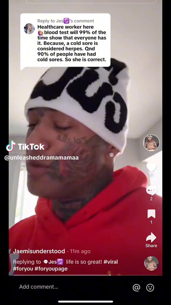 Supreme Tingz Him and his girl have been all up and down TikTok and they said he allegedly gave her herpes and he said she allegedly gave it to him? some kinda weird mess