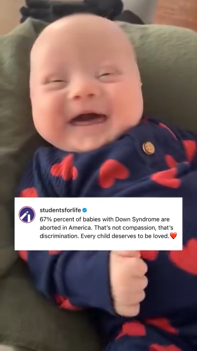 This is devastating. Children with Down Syndrome bring this world so much joy. Abortion fuels ableism.
