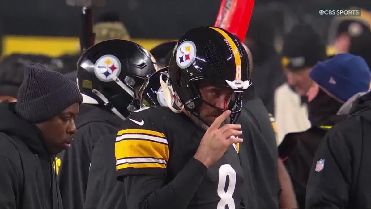 Aaron Rodgers left the game after taking a big hit from Joey Bosa 😬 (via NFL on CBS 🏈)