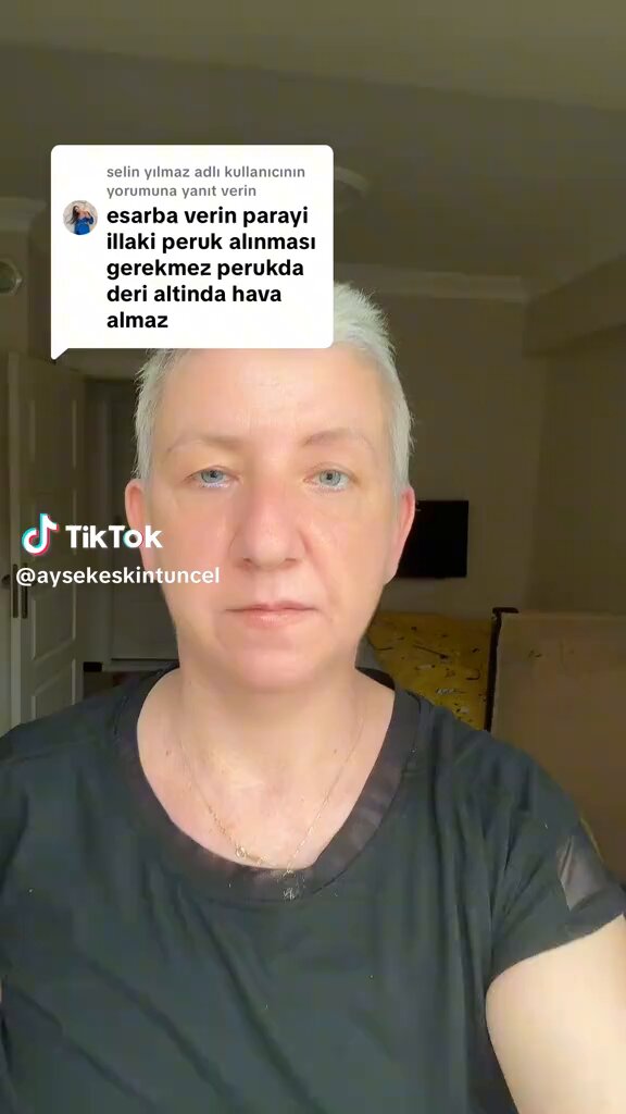 Kanser hastası bir vatandaş, videosunun altına gelen ‘peruğa vereceğin parayı eşarba ver’ yorumuna tepki gösterdi: “Eşarp ayrı, peruk ayrı. Başı kapalı biriyseniz başörtü sizin için kamuflaj olabilir ama benim peruğa ihtiyacım var. Umarım kimse bunu yaşamak zorunda kalmaz ve yorumlarınızı buna göre yaparsınız.” (Ayşe Tunçel)