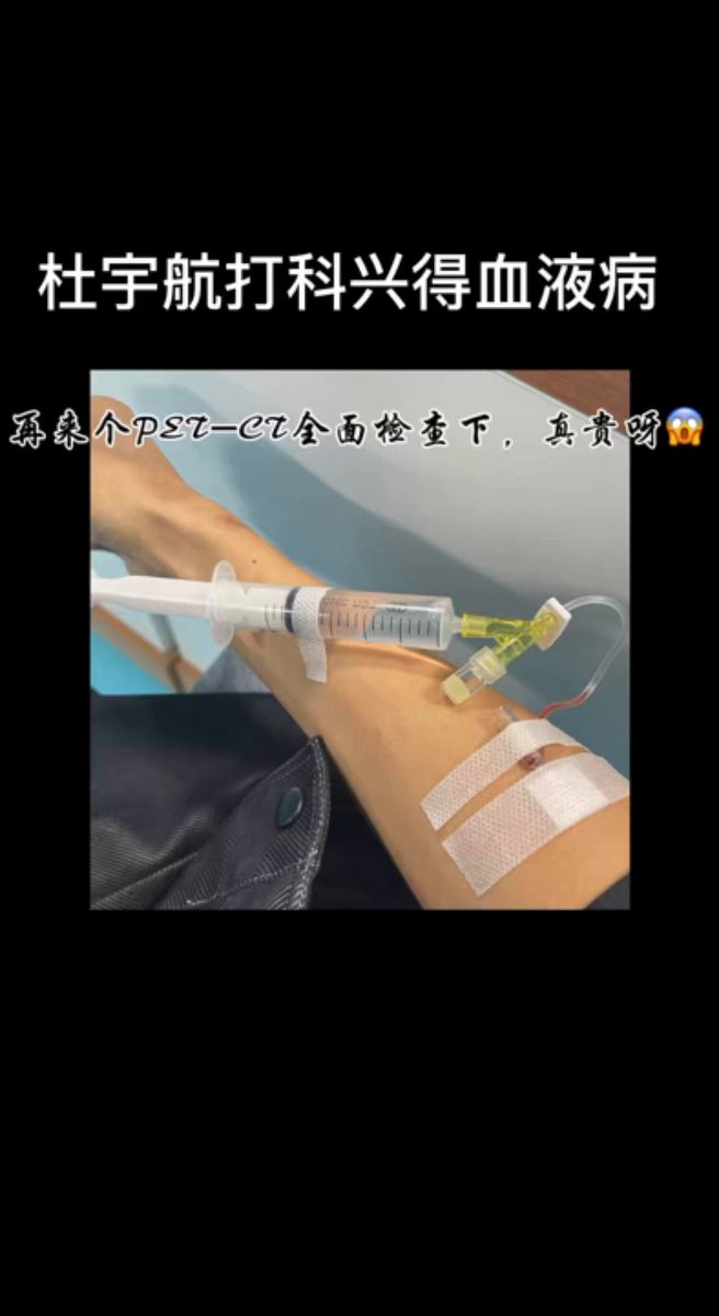 杜宇航：两针疫苗，一场高烧，我的人生彻底改变。响应号召打了科兴疫苗后，便确诊血液再生障碍，之后多次往返天津血液医院治疗……历时两年半总算拿到疫苗异常反应鉴定书，可是疫苗公司给的补偿方案让我大跌眼镜，一次性补偿的金额还不够一年吃药费用”