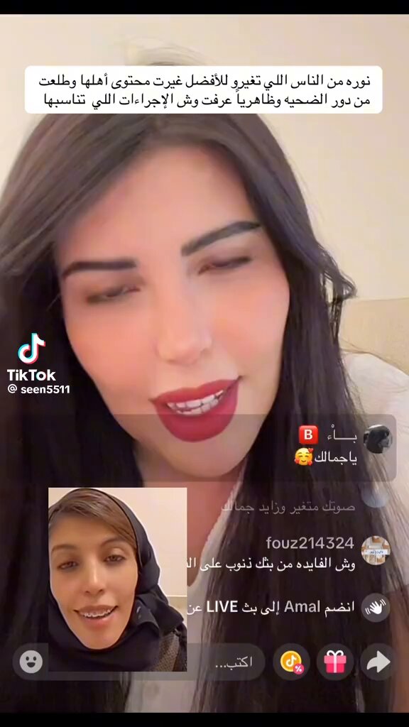 نورة الدوسري اشوفها اكثر وحده تحسنت شكلياً زمان كان وجها نحييييييف واغبر وطوييييييييل الحين وجها مليان ومدور وابيض ياما فيه ناس بشعتهم عمليات التجميل والنفخ إلا هي ناسبها